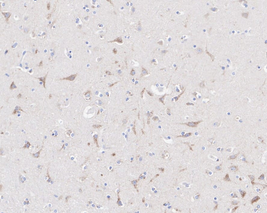 Immunohistochemistry: Sortilin Antibody (JE60-00) [NBP3-32968] - Immunohistochemical analysis of paraffin-embedded human brain tissue with Rabbit anti-Sortilin antibody (NBP3-32968) at 1/500 dilution. The section was pre-treated using heat mediated antigen retrieval with Tris-EDTA buffer (pH 9.0) for 20 minutes. The tissues were blocked in 1% BSA for 20 minutes at room temperature, washed with ddH2O and PBS, and then probed with the primary antibody (NBP3-32968) at 1/500 dilution for 1 hour at room temperature. The detection was performed using an HRP conjugated compact polymer system. DAB was used as the chromogen. Tissues were counterstained with hematoxylin and mounted with DPX.