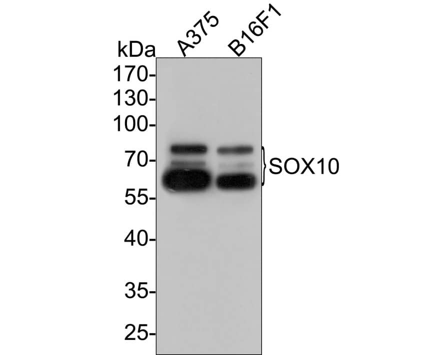 Western Blot: SOX10 Antibody (PDH0-05) [NBP3-32969] - Western blot analysis of SOX10 on different lysates with Rabbit anti-SOX10 antibody (NBP3-32969) at 1/500 dilution. Lane 1: A375 cell lysate Lane 2: B16F1 cell lysate Lysates/proteins at 10 ug/Lane. Predicted band size: 50 kDa Observed band size: 60-75kDa Exposure time: 2 minutes; 10% SDS-PAGE gel. Proteins were transferred to a PVDF membrane and blocked with 5% NFDM/TBST for 1 hour at room temperature. The primary antibody (NBP3-32969) at 1/500 dilution was used in 5% NFDM/TBST at room temperature for 2 hours. Goat Anti-Rabbit IgG - HRP Secondary Antibody at 1:300,000 dilution was used for 1 hour at room temperature.