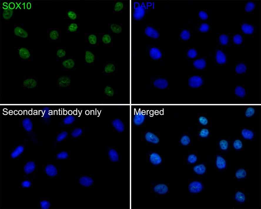 Immunocytochemistry/ Immunofluorescence: SOX10 Antibody (PDH0-05) [NBP3-32969] - Immunocytochemistry analysis of A375 cells labeling SOX10 with Rabbit anti-SOX10 antibody (NBP3-32969) at 1/50 dilution. Cells were fixed in 4% paraformaldehyde for 10 minutes at 37 ℃, permeabilized with 0.05% Triton X-100 in PBS for 20 minutes, and then blocked with 2% negative goat serum for 30 minutes at room temperature. Cells were then incubated with Rabbit anti-SOX10 antibody (NBP3-32969) at 1/50 dilution in 2% negative goat serum overnight at 4 ℃. Goat Anti-Rabbit IgG H&L (iFluor™ 488) was used as the secondary antibody at 1/1,000 dilution. PBS instead of the primary antibody was used as the secondary antibody only control. Nuclear DNA was labelled in blue with DAPI.