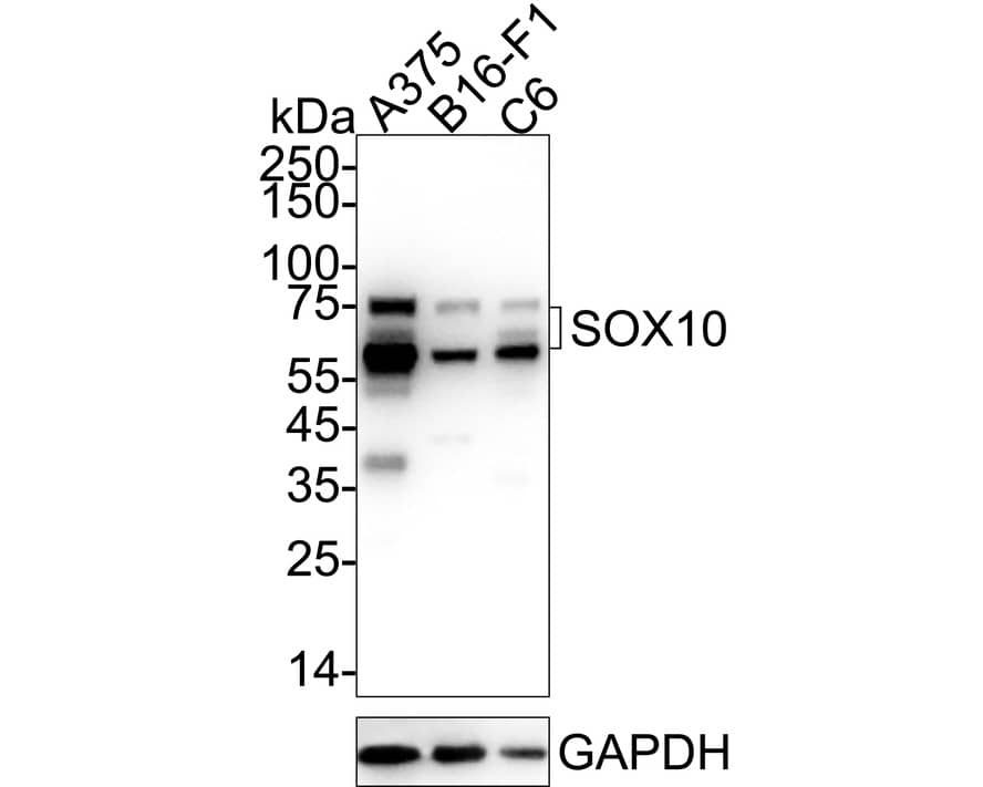 Western blot analysis on different lysates with NBP3-32970 at 1/1,000 dilution. Lane 1: A375 cell lysate Lane 2: B16-F1 cell lysate Lane 3: C6 cell lysate Lysates/proteins at 20 µg/Lane. Predicted band size: 50 kDa Observed band size: 60-75 kDa Exposure time: 4 seconds;  4-20% SDS-PAGE gel. Proteins were transferred to a PVDF membrane and blocked with 5% NFDM/TBST for 1 hour at room temperature. NBP3-32970 at 1/1,000 dilution was used in 5% NFDM/TBST at 4℃ overnight. Goat Anti-Rabbit IgG [HRP] Secondary Antibody at 1/50,000 dilution was used for 1 hour at room temperature.