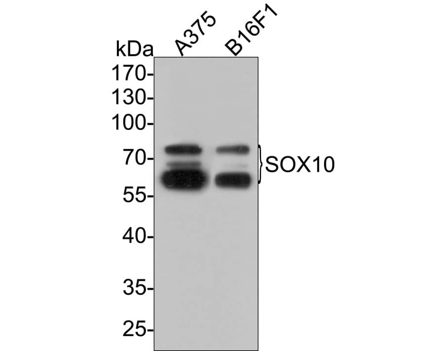 Western Blot: SOX10 Antibody (PDH0-03) [NBP3-32970] - Western blot analysis of SOX10 on different lysates with Rabbit anti-SOX10 antibody (NBP3-32970) at 1/2,000 dilution. Lane 1: A375 cell lysate Lane 2: B16F1 cell lysate Lysates/proteins at 10 ug/Lane. Predicted band size: 50 kDa Observed band size: 60-75kDa Exposure time: 2 minutes; 10% SDS-PAGE gel. Proteins were transferred to a PVDF membrane and blocked with 5% NFDM/TBST for 1 hour at room temperature. The primary antibody (NBP3-32970) at 1/2,000 dilution was used in 5% NFDM/TBST at room temperature for 2 hours. Goat Anti-Rabbit IgG - HRP Secondary Antibody at 1:300,000 dilution was used for 1 hour at room temperature.