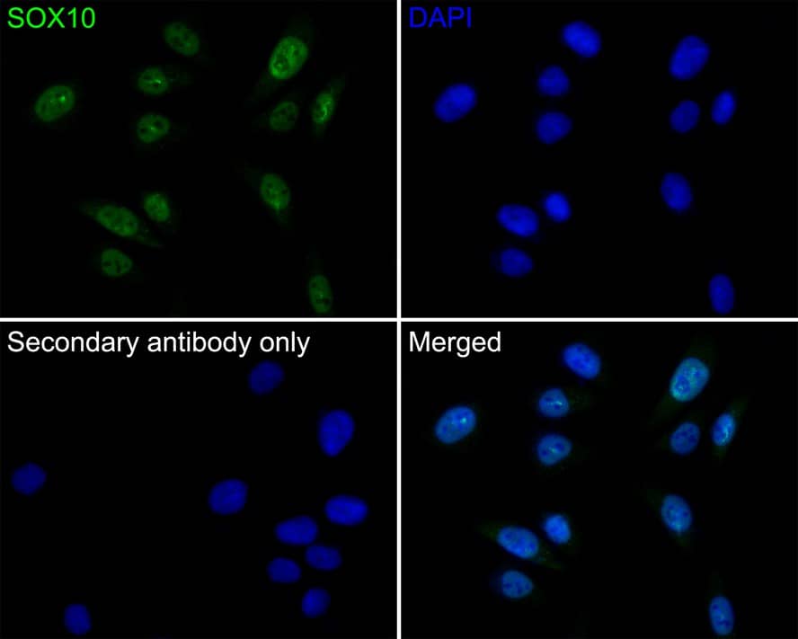 Immunocytochemistry/ Immunofluorescence: SOX10 Antibody (PDH0-03) [NBP3-32970] - Immunocytochemistry analysis of A375 cells labeling SOX10 with Rabbit anti-SOX10 antibody (NBP3-32970) at 1/50 dilution. Cells were fixed in 4% paraformaldehyde for 10 minutes at 37 ℃, permeabilized with 0.05% Triton X-100 in PBS for 20 minutes, and then blocked with 2% negative goat serum for 30 minutes at room temperature. Cells were then incubated with Rabbit anti-SOX10 antibody (NBP3-32970) at 1/50 dilution in 2% negative goat serum overnight at 4 ℃. Goat Anti-Rabbit IgG H&L (iFluor™ 488) was used as the secondary antibody at 1/1,000 dilution. PBS instead of the primary antibody was used as the secondary antibody only control. Nuclear DNA was labelled in blue with DAPI.