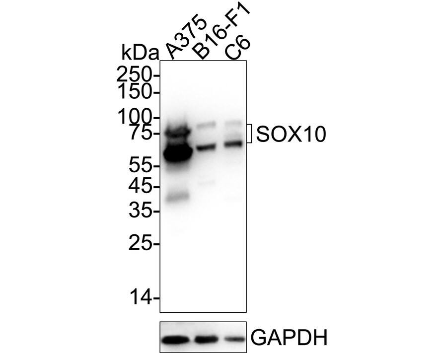 Western blot analysis on different lysates with NBP3-32971 at 1/1,000 dilution. Lane 1: A375 cell lysate Lane 2: B16-F1 cell lysate Lane 3: C6 cell lysate Lysates/proteins at 20 µg/Lane. Predicted band size: 50 kDa Observed band size: 60-75 kDa Exposure time: 4 seconds;  4-20% SDS-PAGE gel. Proteins were transferred to a PVDF membrane and blocked with 5% NFDM/TBST for 1 hour at room temperature. NBP3-32971 at 1/1,000 dilution was used in 5% NFDM/TBST at 4℃ overnight. Goat Anti-Rabbit IgG [HRP] Secondary Antibody at 1/50,000 dilution was used for 1 hour at room temperature.