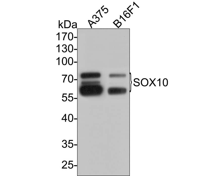 Western Blot: SOX10 Antibody (PDH0-04) [NBP3-32971] - Western blot analysis of SOX10 on different lysates with Rabbit anti-SOX10 antibody (NBP3-32971) at 1/2,000 dilution. Lane 1: A375 cell lysate Lane 2: B16F1 cell lysate Lysates/proteins at 10 ug/Lane. Predicted band size: 50 kDa Observed band size: 60-75kDa Exposure time: 2 minutes; 10% SDS-PAGE gel. Proteins were transferred to a PVDF membrane and blocked with 5% NFDM/TBST for 1 hour at room temperature. The primary antibody (NBP3-32971) at 1/2,000 dilution was used in 5% NFDM/TBST at room temperature for 2 hours. Goat Anti-Rabbit IgG - HRP Secondary Antibody at 1:300,000 dilution was used for 1 hour at room temperature.