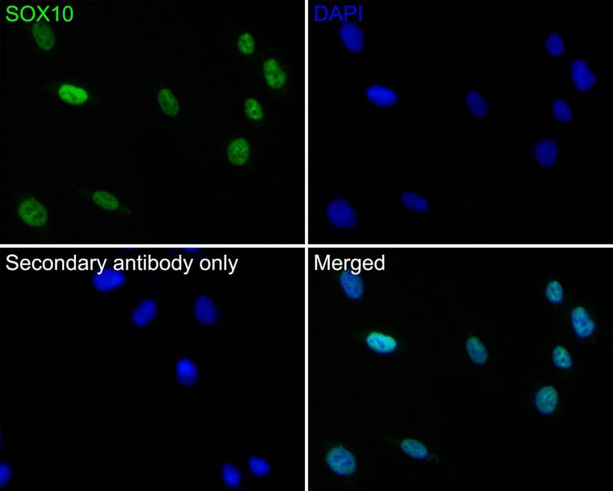 Immunocytochemistry/ Immunofluorescence: SOX10 Antibody (PDH0-04) [NBP3-32971] - Immunocytochemistry analysis of A375 cells labeling SOX10 with Rabbit anti-SOX10 antibody (NBP3-32971) at 1/50 dilution. Cells were fixed in 4% paraformaldehyde for 10 minutes at 37 ℃, permeabilized with 0.05% Triton X-100 in PBS for 20 minutes, and then blocked with 2% negative goat serum for 30 minutes at room temperature. Cells were then incubated with Rabbit anti-SOX10 antibody (NBP3-32971) at 1/50 dilution in 2% negative goat serum overnight at 4 ℃. Goat Anti-Rabbit IgG H&L (iFluor™ 488) was used as the secondary antibody at 1/1,000 dilution. PBS instead of the primary antibody was used as the secondary antibody only control. Nuclear DNA was labelled in blue with DAPI.