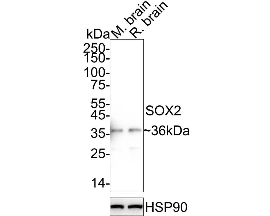 Western blot analysis on different lysates with NBP3-32972 at 1/1,000 dilution. Lane 1: Mouse brain tissue lysate Lane 2: Rat brain tissue lysate Lysates/proteins at 30 µg/Lane. Predicted band size: 34 kDa Observed band size: 36 kDa Exposure time: 25 seconds;  4-20% SDS-PAGE gel. Proteins were transferred to a PVDF membrane and blocked with 5% NFDM/TBST for 1 hour at room temperature. NBP3-32972 at 1/1,000 dilution was used in 5% NFDM/TBST at 4℃ overnight. Goat Anti-Rabbit IgG [HRP] Secondary Antibody at 1/50,000 dilution was used for 1 hour at room temperature.