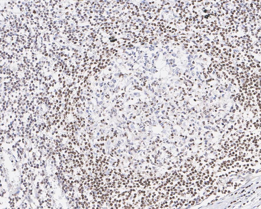 Immunohistochemistry: SP110 Antibody (PSH03-66) [NBP3-32973] - Immunohistochemical analysis of paraffin-embedded human lymph node tissue with Rabbit anti-SP110 antibody (NBP3-32973) at 1/2,000 dilution. The section was pre-treated using heat mediated antigen retrieval with sodium citrate buffer (pH 6.0) for 2 minutes. The tissues were blocked in 1% BSA for 20 minutes at room temperature, washed with ddH2O and PBS, and then probed with the primary antibody (NBP3-32973) at 1/2,000 dilution for 1 hour at room temperature. The detection was performed using an HRP conjugated compact polymer system. DAB was used as the chromogen. Tissues were counterstained with hematoxylin and mounted with DPX.