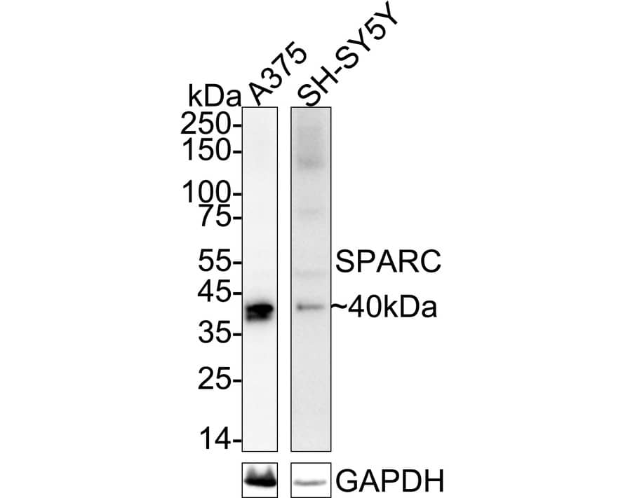Western blot analysis on different lysates with NBP3-32974 at 1/5,000 dilution. Lane 1: A375 cell lysate Lane 2: SH-SY5Y cell lysate Lysates/proteins at 20 µg/Lane. Predicted band size: 35 kDa Observed band size: 40 kDa Exposure time: Lane 1: 59 seconds; Lane 2: 3 minutes;  4-20% SDS-PAGE gel. Proteins were transferred to a PVDF membrane and blocked with 5% NFDM/TBST for 1 hour at room temperature. NBP3-32974 at 1/5,000 dilution was used in primary antibody dilution at 4℃ overnight. Goat Anti-Rabbit IgG [HRP] Secondary Antibody at 1/50,000 dilution was used for 1 hour at room temperature.