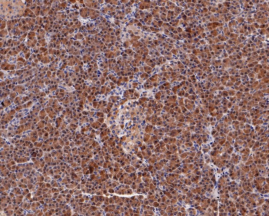 Immunohistochemistry: SPINK1 Antibody (PD00-93) [NBP3-32975] - Immunohistochemical analysis of paraffin-embedded human pancreas tissue with Rabbit anti-SPINK1 antibody (NBP3-32975) at 1/2,000 dilution. The section was pre-treated using heat mediated antigen retrieval with Tris-EDTA buffer (pH 9.0) for 20 minutes. The tissues were blocked in 1% BSA for 20 minutes at room temperature, washed with ddH2O and PBS, and then probed with the primary antibody (NBP3-32975) at 1/2,000 dilution for 1 hour at room temperature. The detection was performed using an HRP conjugated compact polymer system. DAB was used as the chromogen. Tissues were counterstained with hematoxylin and mounted with DPX.