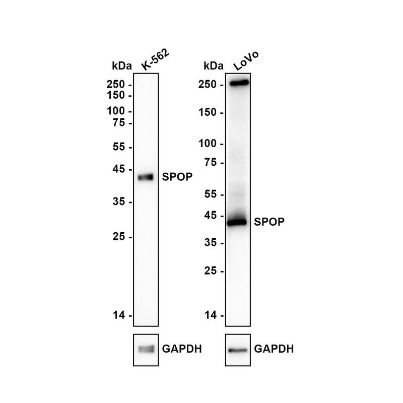 Western Blot SPOP Antibody (JE36-04)