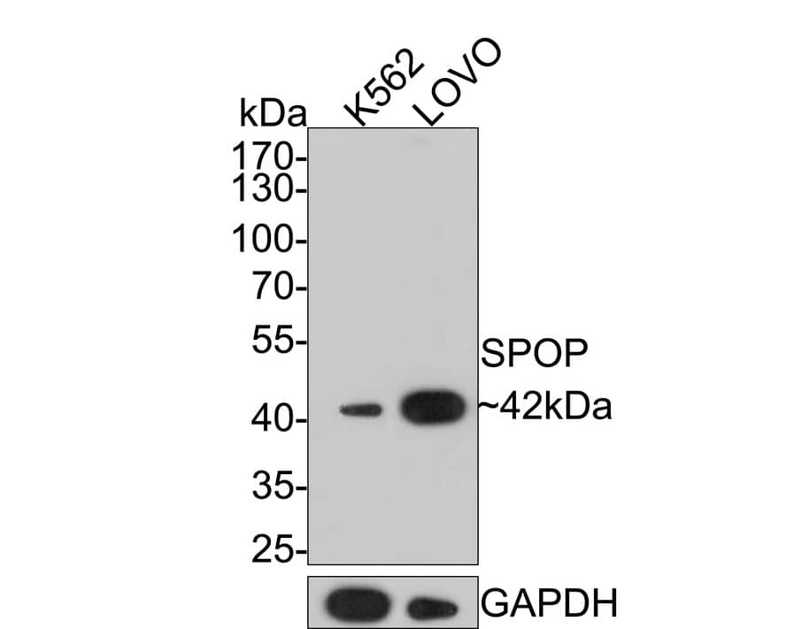 Western Blot: SPOP Antibody (JE36-04) [NBP3-32976] - Western blot analysis of SPOP on different lysates with Rabbit anti-SPOP antibody (NBP3-32976) at 1/500 dilution. Lane 1: K562 cell lysate Lane 2: LOVO cell lysate Lysates/proteins at 10 ug/Lane. Predicted band size: 42 kDa Observed band size: 42 kDa Exposure time: 2 minutes; 10% SDS-PAGE gel. Proteins were transferred to a PVDF membrane and blocked with 5% NFDM/TBST for 1 hour at room temperature. The primary antibody (NBP3-32976) at 1/500 dilution was used in 5% NFDM/TBST at room temperature for 2 hours. Goat Anti-Rabbit IgG - HRP Secondary Antibody at 1:200,000 dilution was used for 1 hour at room temperature.