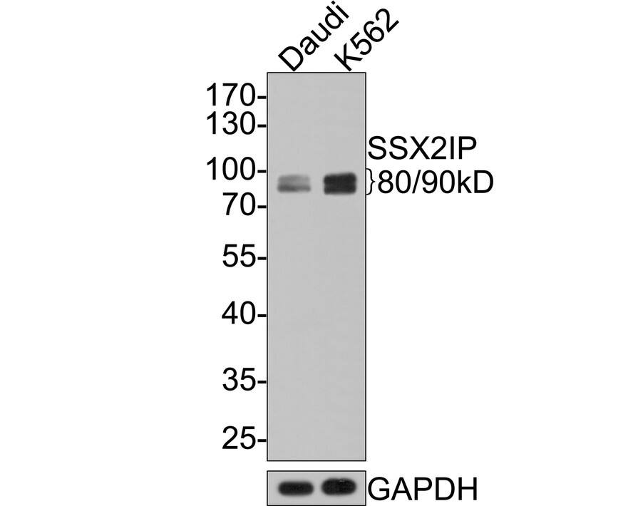 Western blot analysis on different lysates with NBP3-32978 at 1/500 dilution. Lane 1: Daudi cell lysate Lane 2: K562 cell lysate Lysates/proteins at 10 µg/Lane. Predicted band size: 71 kDa Observed band size: 80/90 kDa Exposure time: 2 minutes; 10% SDS-PAGE gel. Proteins were transferred to a PVDF membrane and blocked with 5% NFDM/TBST for 1 hour at room temperature. NBP3-32978 at 1/500 dilution was used in 5% NFDM/TBST at room temperature for 2 hours. Goat Anti-Rabbit IgG [HRP] Secondary Antibody at 1:300,000 dilution was used for 1 hour at room temperature.