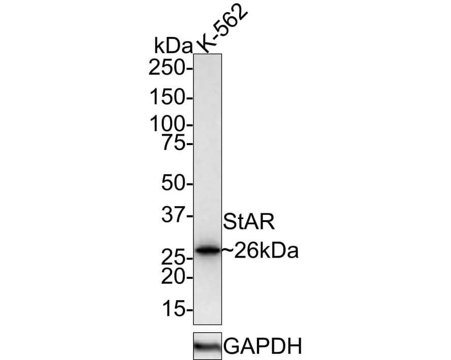 Western Blot: StAR Antibody (JE32-23) [NBP3-32979] - Western blot analysis of StAR on K-562 cell lysates with Rabbit anti-StAR antibody (NBP3-32979) at 1/1,000 dilution. Lysates/proteins at 20 ug/Lane. Predicted band size: 32 kDa Observed band size: 26 kDa Exposure time: 3 minutes; 4-20% SDS-PAGE gel. Proteins were transferred to a PVDF membrane and blocked with 5% NFDM/TBST for 1 hour at room temperature. The primary antibody (NBP3-32979) at 1/1,000 dilution was used in 5% NFDM/TBST at room temperature for 2 hours. Goat Anti-Rabbit IgG - HRP Secondary Antibody at 1:100,000 dilution was used for 1 hour at room temperature.