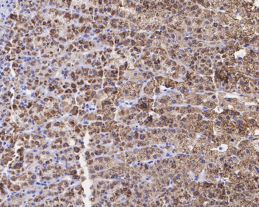 Immunohistochemistry: StAR Antibody (JE32-23) [NBP3-32979] - Immunohistochemical analysis of paraffin-embedded human adrenal gland tissue with Rabbit anti-StAR antibody (NBP3-32979) at 1/1,000 dilution. The section was pre-treated using heat mediated antigen retrieval with Tris-EDTA buffer (pH 9.0) for 20 minutes. The tissues were blocked in 1% BSA for 20 minutes at room temperature, washed with ddH2O and PBS, and then probed with the primary antibody (NBP3-32979) at 1/1,000 dilution for 1 hour at room temperature. The detection was performed using an HRP conjugated compact polymer system. DAB was used as the chromogen. Tissues were counterstained with hematoxylin and mounted with DPX.