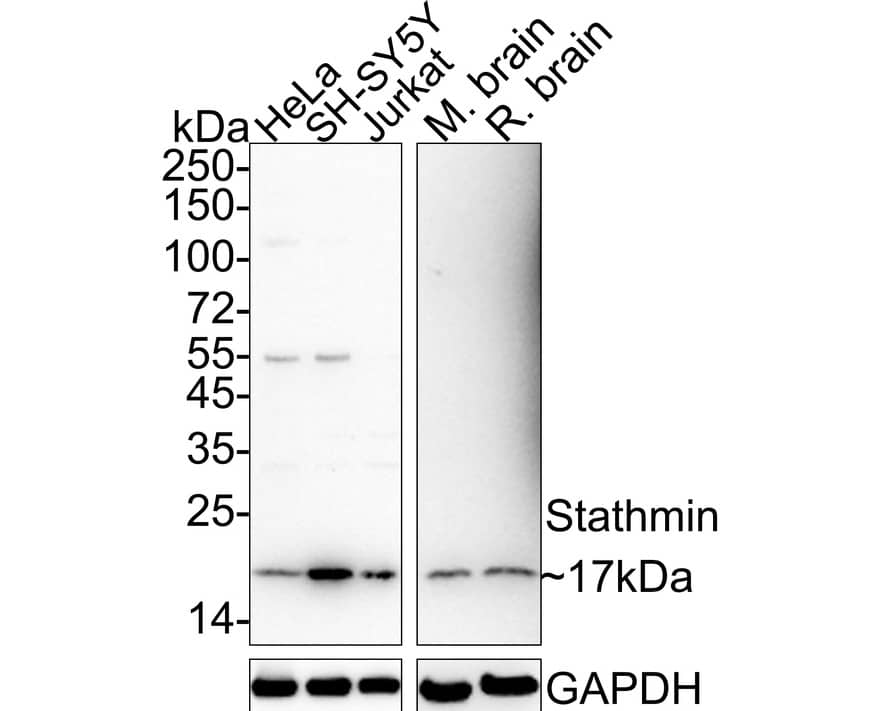 Western blot analysis on different lysates with NBP3-32981 at 1/1,000 dilution. Lane 1: HeLa cell tissue lysate (20 µg/Lane) Lane 2: SH-SY5Y cell tissue lysate (20 µg/Lane) Lane 3: Jurkat cell tissue lysate (20 µg/Lane) Lane 4: Mouse brain tissue lysate (40 µg/Lane) Lane 5: Rat brain tissue lysate (40 µg/Lane) Predicted band size: 17 kDa Observed band size: 17 kDa Exposure time: 3 minutes;  4-20% SDS-PAGE gel. Proteins were transferred to a PVDF membrane and blocked with 5% NFDM/TBST for 1 hour at room temperature. NBP3-32981 at 1/1,000 dilution was used in 5% NFDM/TBST at 4℃ overnight. Goat Anti-Rabbit IgG [HRP] Secondary Antibody at 1/50,000 dilution was used for 1 hour at room temperature.