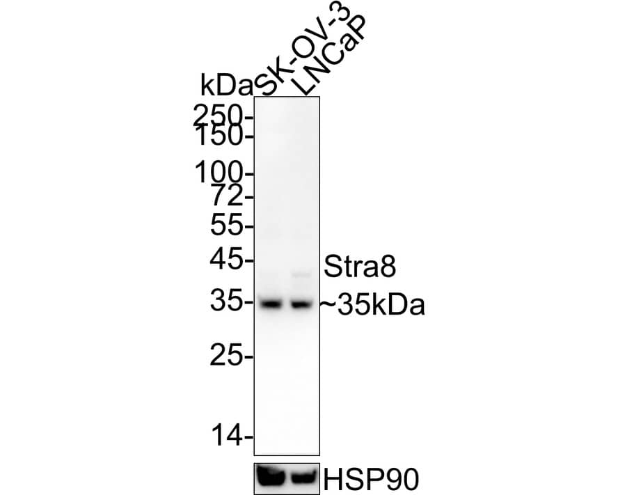 Western Blot STRA8 Antibody (PSH04-55)