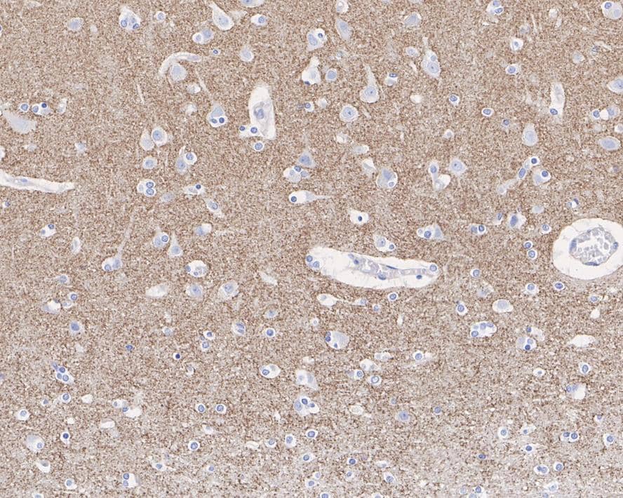 Immunohistochemistry: Synaptophysin Antibody (JE42-51) [NBP3-32986] - Immunohistochemical analysis of paraffin-embedded human brain tissue with Rabbit anti-Synaptophysin antibody (NBP3-32986) at 1/1,000 dilution. The section was pre-treated using heat mediated antigen retrieval with Tris-EDTA buffer (pH 9.0) for 20 minutes. The tissues were blocked in 1% BSA for 20 minutes at room temperature, washed with ddH2O and PBS, and then probed with the primary antibody (NBP3-32986) at 1/1,000 dilution for 1 hour at room temperature. The detection was performed using an HRP conjugated compact polymer system. DAB was used as the chromogen. Tissues were counterstained with hematoxylin and mounted with DPX.