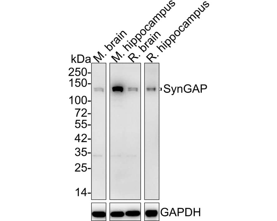Western blot analysis on different lysates with NBP3-32988 at 1/2,000 dilution. Lane 1: Mouse brain tissue lysate (20 µg/Lane) Lane 2: Mouse hippocampus tissue lysate (20 µg/Lane) Lane 3: Rat brain tissue lysate (20 µg/Lane) Lane 4: Rat hippocampus tissue lysate (20 µg/Lane) Predicted band size: 148 kDa Observed band size: 140/148 kDa Exposure time: 1 minute 23 seconds; 4-20% SDS-PAGE gel. Proteins were transferred to a PVDF membrane and blocked with 5% NFDM/TBST for 1 hour at room temperature. NBP3-32988 at 1/2,000 dilution was used in 5% NFDM/TBST at 4℃ overnight. Goat Anti-Rabbit IgG [HRP] Secondary Antibody at 1/50,000 dilution was used for 1 hour at room temperature.