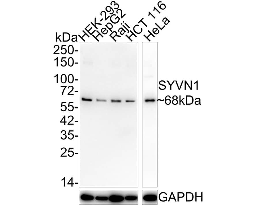 Western Blot: HRD1 Antibody (JE44-67) [NBP3-32991] - Western blot analysis of HRD1 on different lysates with Rabbit anti-HRD1 antibody (NBP3-32991) at 1/2,000 dilution. Lane 1: HEK-293 cell lysate Lane 2: HepG2 cell lysate Lane 3: Raji cell lysate Lane 4: HCT 116 cell lysate Lane 5: HeLa cell lysate Lysates/proteins at 20 ug/Lane. Predicted band size: 68 kDa Observed band size: 68 kDa Exposure time: 1 minute; 4-20% SDS-PAGE gel. Proteins were transferred to a PVDF membrane and blocked with 5% NFDM/TBST for 1 hour at room temperature. The primary antibody (NBP3-32991) at 1/2,000 dilution was used in 5% NFDM/TBST at 4C overnight. Goat Anti-Rabbit IgG - HRP Secondary Antibody at 1/50,000 dilution was used for 1 hour at room temperature.