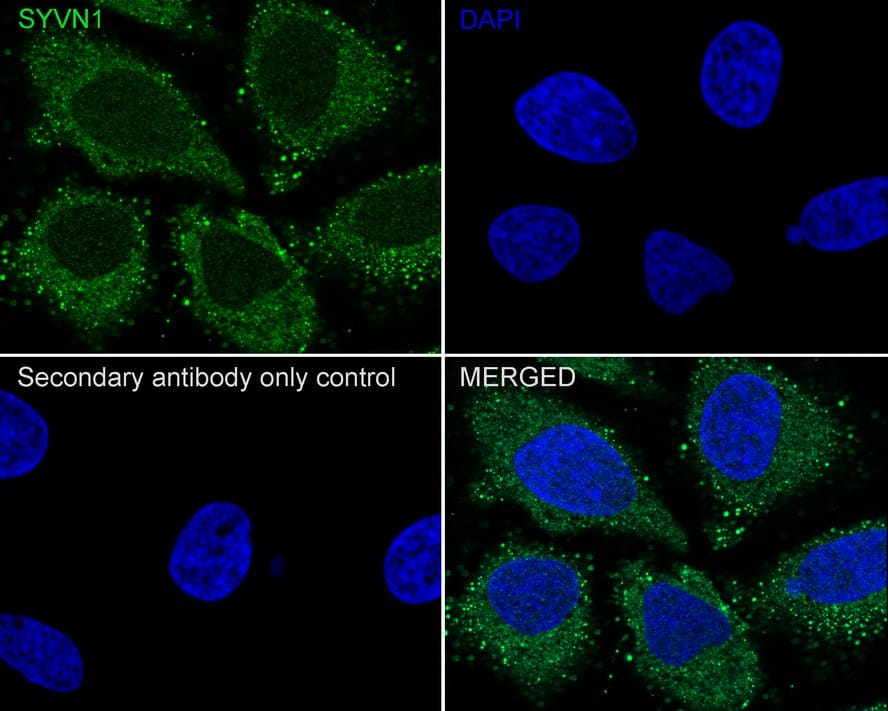 Immunocytochemistry/ Immunofluorescence: HRD1 Antibody (JE44-67) [NBP3-32991] - Immunocytochemistry analysis of HeLa cells labeling HRD1 with Rabbit anti-HRD1 antibody (NBP3-32991) at 1/100 dilution. Cells were fixed in 4% paraformaldehyde for 20 minutes at room temperature, permeabilized with 0.1% Triton X-100 in PBS for 5 minutes at room temperature, then blocked with 1% BSA in 10% negative goat serum for 1 hour at room temperature. Cells were then incubated with Rabbit anti-HRD1 antibody (NBP3-32991) at 1/100 dilution in 1% BSA in PBST overnight at 4 ℃. Goat Anti-Rabbit IgG H&L (iFluor™ 488) was used as the secondary antibody at 1/1,000 dilution. PBS instead of the primary antibody was used as the secondary antibody only control. Nuclear DNA was labelled in blue with DAPI.