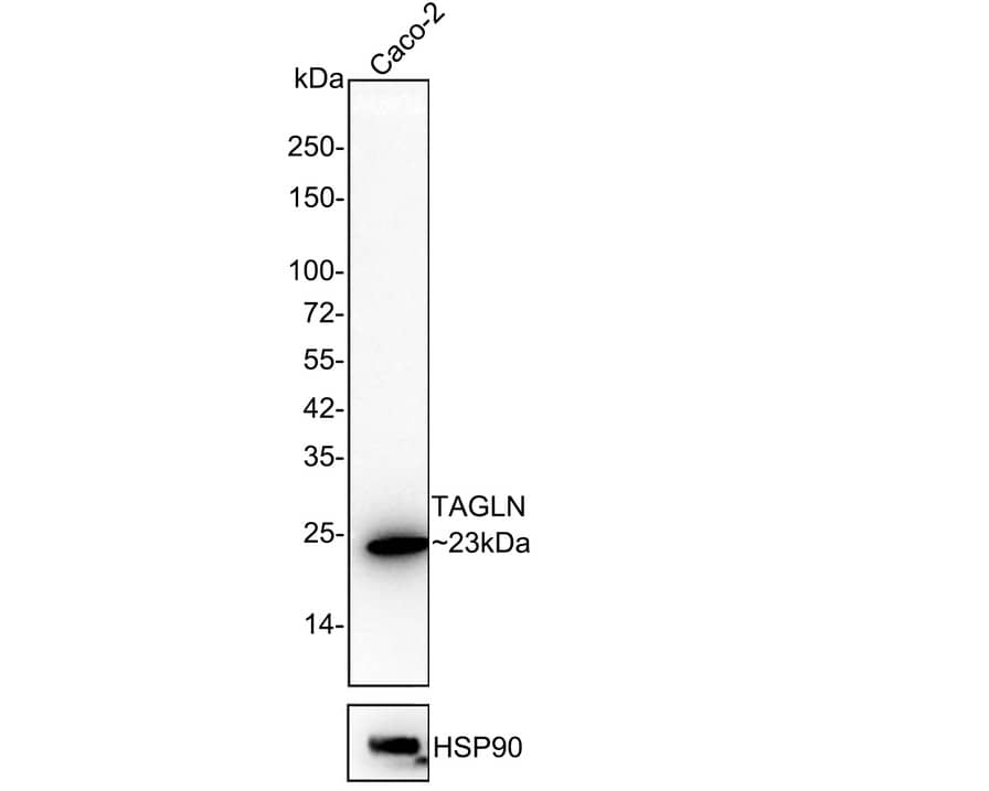 Western blot analysis of  Caco-2 cell lysates with NBP3-32992 at 1/2,000 dilution. Lysates/proteins at 20 µg/Lane. Predicted band size: 23 kDa Observed band size: 23 kDa Exposure time: 1 minutes 34 seconds; 4-20% SDS-PAGE gel. Proteins were transferred to a PVDF membrane and blocked with 5% NFDM/TBST for 1 hour at room temperature. NBP3-32992 at 1/2,000 dilution was used in 5% NFDM/TBST at 4℃ overnight. Goat Anti-Rabbit IgG [HRP] Secondary Antibody at 1/50,000 dilution was used for 1 hour at room temperature.
