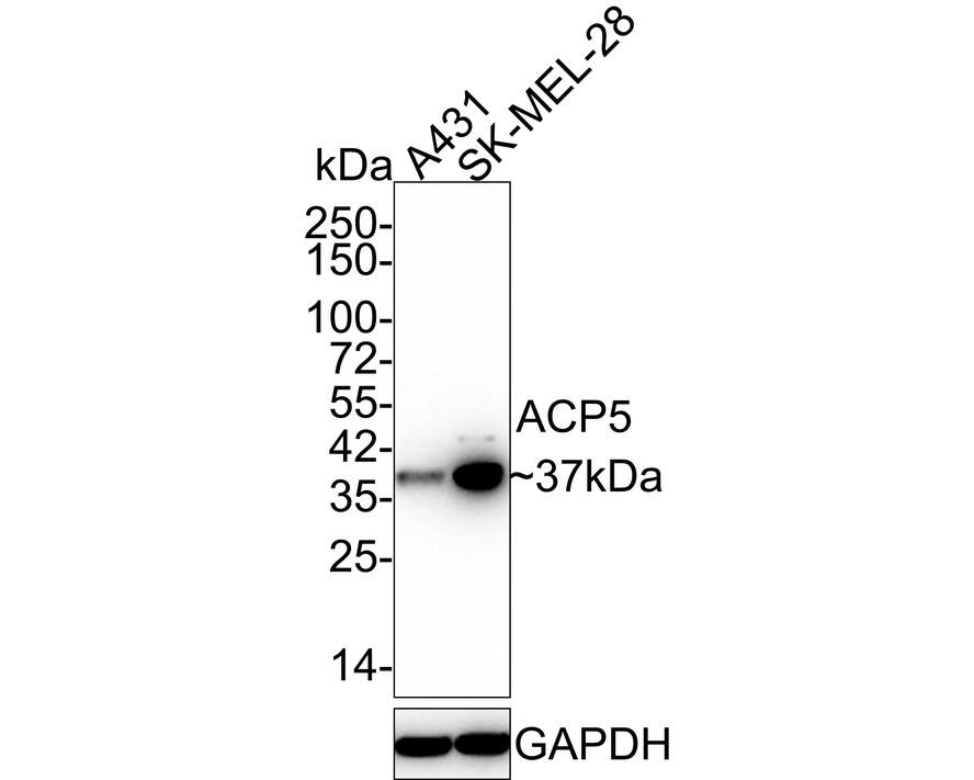 Western blot analysis on different lysates with NBP3-32994 at 1/2,000 dilution. Lane 1: A431 cell lysate Lane 2: SK-MEL-28 cell lysate Lysates/proteins at 30 µg/Lane. Predicted band size: 37 kDa Observed band size: 37 kDa Exposure time: 3 minutes 20 seconds; 4-20% SDS-PAGE gel. Proteins were transferred to a PVDF membrane and blocked with 5% NFDM/TBST for 1 hour at room temperature. NBP3-32994 at 1/2,000 dilution was used in 5% NFDM/TBST at 4℃ overnight. Goat Anti-Rabbit IgG [HRP] Secondary Antibody at 1/50,000 dilution was used for 1 hour at room temperature.