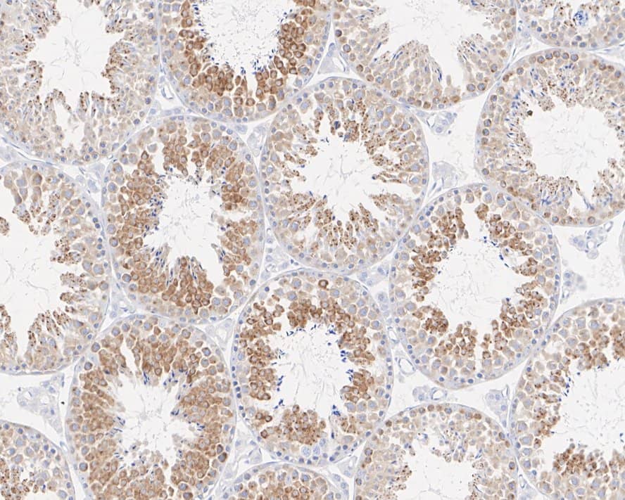 Immunohistochemistry: TAX1BP1 Antibody (JE34-80) [NBP3-32996] - Immunohistochemical analysis of paraffin-embedded mouse testis tissue with Rabbit anti-TAX1BP1 antibody (NBP3-32996) at 1/1,000 dilution. The section was pre-treated using heat mediated antigen retrieval with sodium citrate buffer (pH 6.0) for 2 minutes. The tissues were blocked in 1% BSA for 20 minutes at room temperature, washed with ddH2O and PBS, and then probed with the primary antibody (NBP3-32996) at 1/1,000 dilution for 1 hour at room temperature. The detection was performed using an HRP conjugated compact polymer system. DAB was used as the chromogen. Tissues were counterstained with hematoxylin and mounted with DPX.