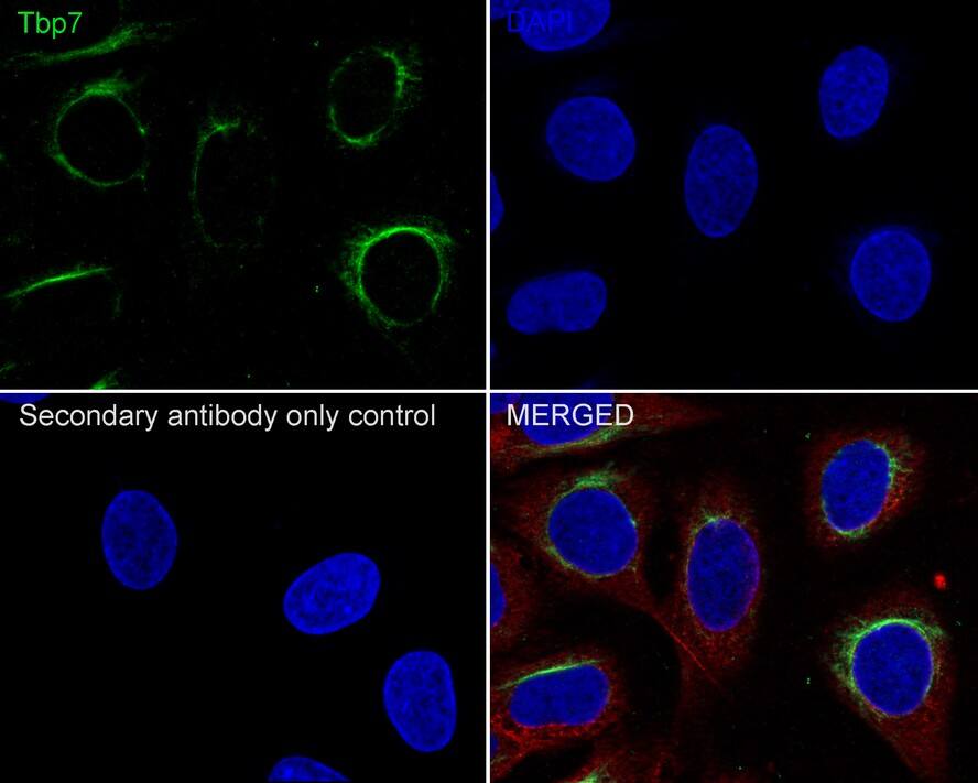 Immunocytochemistry/ Immunofluorescence: Tbp7 Antibody (JE62-72) [NBP3-32997] - Immunocytochemistry analysis of U-2 OS cells labeling Tbp7 with Rabbit anti-Tbp7 antibody (NBP3-32997) at 1/100 dilution. Cells were fixed in 4% paraformaldehyde for 10 minutes at 37 ℃, permeabilized with 0.05% Triton X-100 in PBS for 20 minutes, and then blocked with 2% negative goat serum for 30 minutes at room temperature. Cells were then incubated with Rabbit anti-Tbp7 antibody (NBP3-32997) at 1/100 dilution in 2% negative goat serum overnight at 4 ℃. Goat Anti-Rabbit IgG H&L (iFluor™ 488) was used as the secondary antibody at 1/1,000 dilution. Nuclear DNA was labelled in blue with DAPI. Beta tubulin (red) was stained at 1/200 dilution overnight at +4℃. Goat Anti-Mouse IgG H&L (iFluor™ 594) was used as the secondary antibody at 1/1,000 dilution.