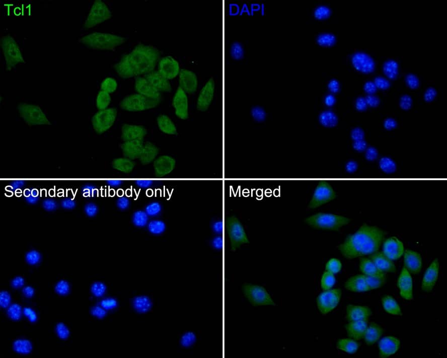 Immunocytochemistry/ Immunofluorescence: TCL1A Antibody (PD00-94) [NBP3-33001] - Immunocytochemistry analysis of PC-3 cells labeling TCL1A with Rabbit anti-TCL1A antibody (NBP3-33001) at 1/50 dilution. Cells were fixed in 4% paraformaldehyde for 10 minutes at 37 ℃, permeabilized with 0.05% Triton X-100 in PBS for 20 minutes, and then blocked with 2% negative goat serum for 30 minutes at room temperature. Cells were then incubated with Rabbit anti-TCL1A antibody (NBP3-33001) at 1/50 dilution in 2% negative goat serum overnight at 4 ℃. Goat Anti-Rabbit IgG H&L (iFluor™ 488) was used as the secondary antibody at 1/1,000 dilution. PBS instead of the primary antibody was used as the secondary antibody only control. Nuclear DNA was labelled in blue with DAPI.