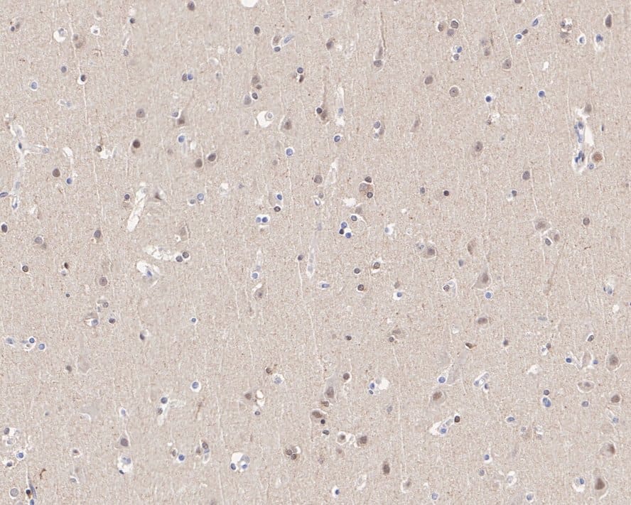 Immunohistochemistry: TDP1 Antibody (PSH0-93) [NBP3-33002] - Immunohistochemical analysis of paraffin-embedded human brain tissue with Rabbit anti-TDP1 antibody (NBP3-33002) at 1/1,000 dilution. The section was pre-treated using heat mediated antigen retrieval with Tris-EDTA buffer (pH 9.0) for 20 minutes. The tissues were blocked in 1% BSA for 20 minutes at room temperature, washed with ddH2O and PBS, and then probed with the primary antibody (NBP3-33002) at 1/1,000 dilution for 1 hour at room temperature. The detection was performed using an HRP conjugated compact polymer system. DAB was used as the chromogen. Tissues were counterstained with hematoxylin and mounted with DPX.