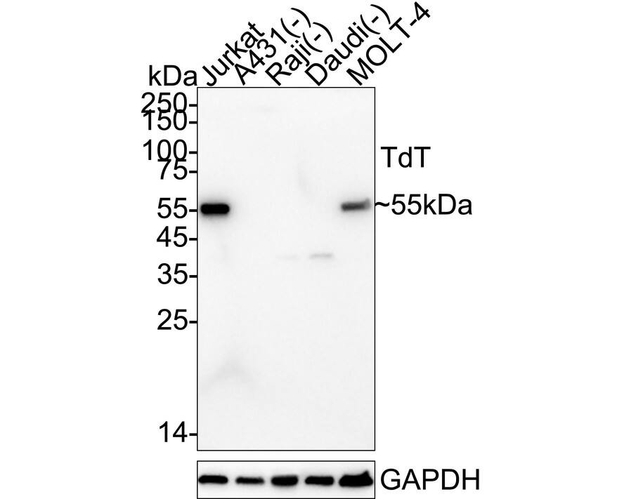 Western blot analysis on different lysates with NBP3-33003 at 1/1,000 dilution. Lane 1: Jurkat cell lysate (20 µg/Lane) Lane 2: A431 cell lysate (negative) (20 µg/Lane) Lane 3: Raji cell lysate (negative) (20 µg/Lane) Lane 4: Daudi cell lysate (negative) (20 µg/Lane) Lane 5: MOLT-4 cell lysate (20 µg/Lane) Predicted band size: 59 kDa Observed band size: 55 kDa Exposure time: 1 minute;  4-20% SDS-PAGE gel. Proteins were transferred to a PVDF membrane and blocked with 5% NFDM/TBST for 1 hour at room temperature. NBP3-33003 at 1/1,000 dilution was used in 5% NFDM/TBST at 4℃ overnight. Goat Anti-Rabbit IgG [HRP] Secondary Antibody at 1/50,000 dilution was used for 1 hour at room temperature.