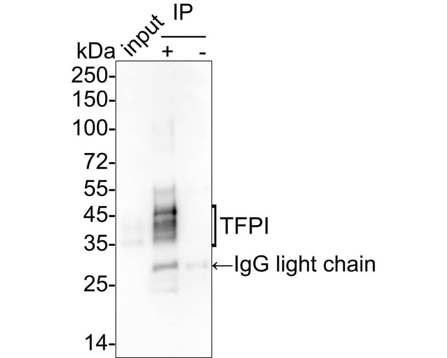 Immunoprecipitation: TFPI Antibody (JE40-58) [NBP3-33007] - TFPI was immunoprecipitated from 0.2 mg HepG2 cell lysate with NBP3-33007 at 2 ug/25 ul agarose. Western blot was performed from the immunoprecipitate using NBP3-33007 at 1/1,000 dilution. Anti-Rabbit IgG for IP Nano-secondary antibody at 1/5,000 dilution was used for 1 hour at room temperature. Lane 1: HepG2 cell lysate (input) Lane 2: NBP3-33007 IP in HepG2 cell lysate Lane 3: Rabbit IgG instead of NBP3-33007 in HepG2 cell lysate Blocking/Dilution buffer: 5% NFDM/TBST Exposure time: 52 seconds; ECL