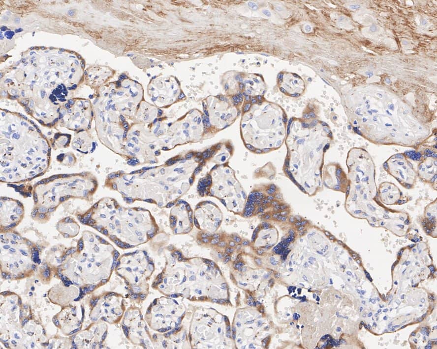 Immunohistochemistry: TFPI Antibody (JE40-58) [NBP3-33007] - Immunohistochemical analysis of paraffin-embedded human placenta tissue with Rabbit anti-TFPI antibody (NBP3-33007) at 1/200 dilution. The section was pre-treated using heat mediated antigen retrieval with Tris-EDTA buffer (pH 9.0) for 20 minutes. The tissues were blocked in 1% BSA for 20 minutes at room temperature, washed with ddH2O and PBS, and then probed with the primary antibody (NBP3-33007) at 1/200 dilution for 1 hour at room temperature. The detection was performed using an HRP conjugated compact polymer system. DAB was used as the chromogen. Tissues were counterstained with hematoxylin and mounted with DPX.