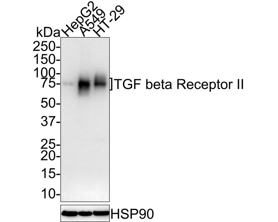 Western blot analysis on different lysates with NBP3-33010 at 1/1,000 dilution. Lane 1: HepG2 cell lysate Lane 2: A549 cell lysate Lane 3: HT-29 cell lysate Lysates/proteins at 30 µg/Lane. Predicted band size: 65 kDa Observed band size: 65-80 kDa Exposure time: 3 minutes 10 seconds; 4-20% SDS-PAGE gel. Proteins were transferred to a PVDF membrane and blocked with 5% NFDM/TBST for 1 hour at room temperature. NBP3-33010 at 1/1,000 dilution was used in 5% NFDM/TBST at room temperature for 2 hours. Goat Anti-Rabbit IgG [HRP] Secondary Antibody at 1/100,000 dilution was used for 1 hour at room temperature.