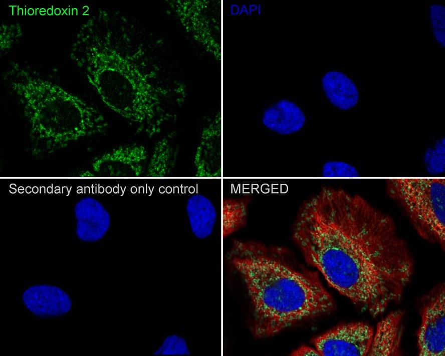 Immunocytochemistry/ Immunofluorescence: Thioredoxin-2 Antibody (JE35-76) [NBP3-33011] - Immunocytochemistry analysis of HeLa cells labeling Thioredoxin-2 with Rabbit anti-Thioredoxin-2 antibody (NBP3-33011) at 1/100 dilution. Cells were fixed in 4% paraformaldehyde for 20 minutes at room temperature, permeabilized with 0.1% Triton X-100 in PBS for 5 minutes at room temperature, then blocked with 1% BSA in 10% negative goat serum for 1 hour at room temperature. Cells were then incubated with Rabbit anti-Thioredoxin-2 antibody (NBP3-33011) at 1/100 dilution in 1% BSA in PBST overnight at 4 ℃. Goat Anti-Rabbit IgG H&L (iFluor™ 488) was used as the secondary antibody at 1/1,000 dilution. PBS instead of the primary antibody was used as the secondary antibody only control. Nuclear DNA was labelled in blue with DAPI. Beta tubulin (red) was stained at 1/100 dilution overnight at +4℃. Goat Anti-Mouse IgG H&L (iFluor™ 594) was used as the secondary antibody at 1/1,000 dilution.