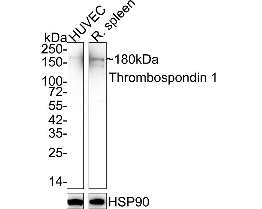 Western blot analysis on different lysates with NBP3-33012 at 1/2,000 dilution. Lane 1: HUVEC cell lysate Lane 2: Rat spleen tissue lysate Lysates/proteins at 40 µg/Lane. Predicted band size: 129 kDa Observed band size: 180 kDa Exposure time: 1 minutes 2 seconds;  4-20% SDS-PAGE gel. Proteins were transferred to a PVDF membrane and blocked with 5% NFDM/TBST for 1 hour at room temperature. NBP3-33012 at 1/2,000 dilution was used in 5% NFDM/TBST at 4℃ overnight. Goat Anti-Rabbit IgG [HRP] Secondary Antibody at 1/50,000 dilution was used for 1 hour at room temperature.