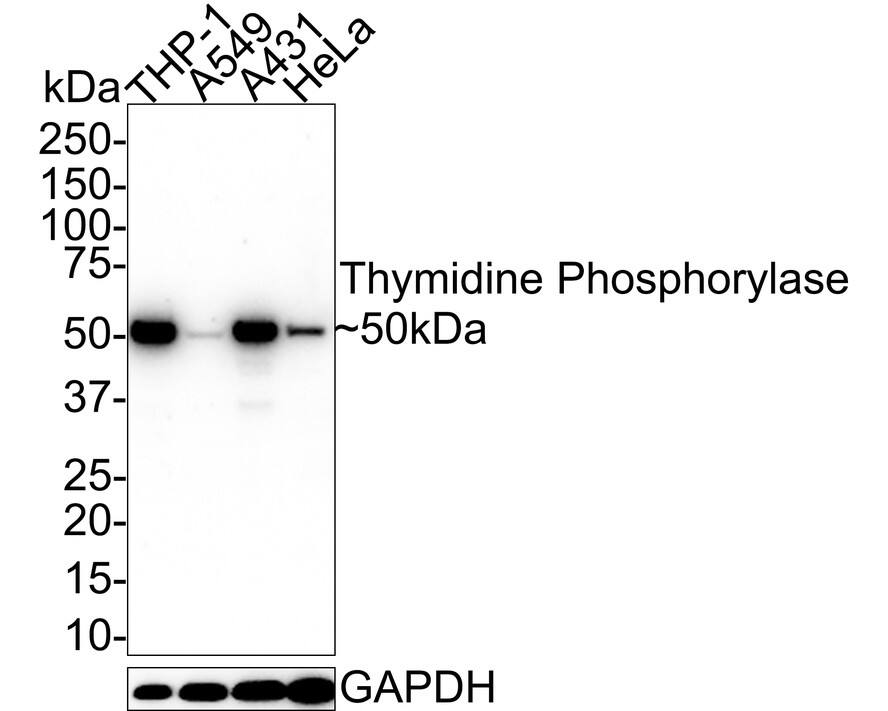 Western blot analysis on different lysates with NBP3-33013 at 1/1,000 dilution. Lane 1: THP-1 cell lysate Lane 2: A549 cell lysate Lane 3: A431 cell lysate Lane 4: HeLa cell lysate Lysates/proteins at 20 µg/Lane. Predicted band size: 50 kDa Observed band size: 50 kDa Exposure time: 25 seconds; 4-20% SDS-PAGE gel. Proteins were transferred to a PVDF membrane and blocked with 5% NFDM/TBST for 1 hour at room temperature. NBP3-33013 at 1/1,000 dilution was used in 5% NFDM/TBST at 4℃ overnight. Goat anti-Mouse IgG [HRP] at 1/50,000 dilution was used for 1 hour at room temperature.