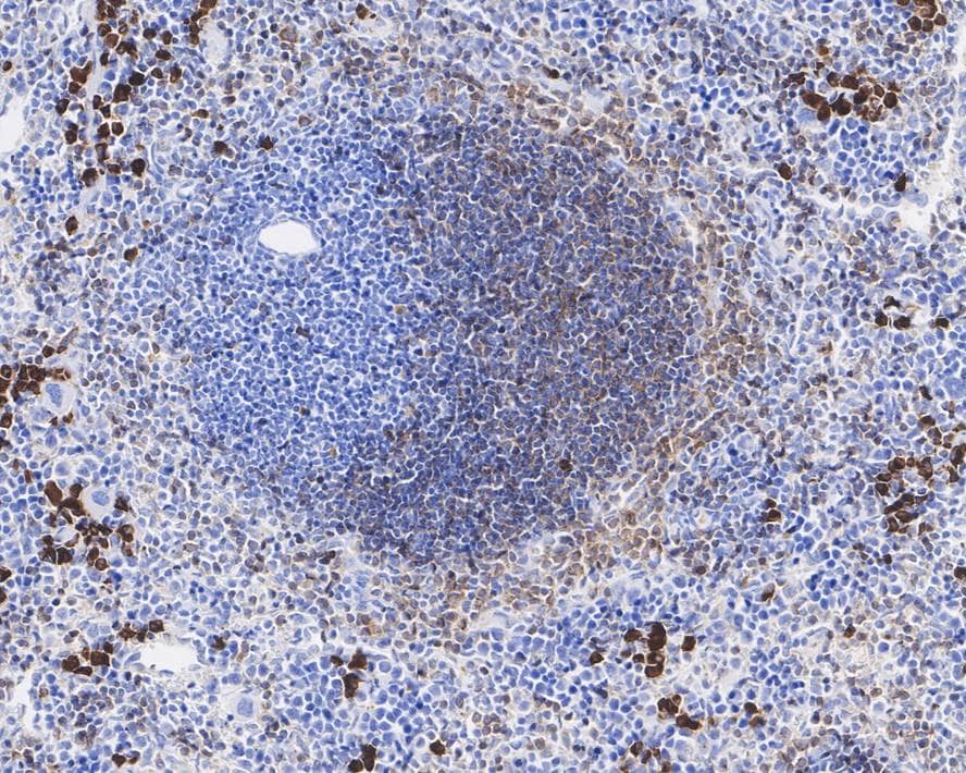 Immunohistochemistry: PD-ECGF/Thymidine Phosphorylase Antibody (A1A10-R) [NBP3-33013] - Immunohistochemical analysis of paraffin-embedded mouse spleen tissue with Mouse anti-PD-ECGF/Thymidine Phosphorylase antibody (NBP3-33013) at 1/10,000 dilution. The section was pre-treated using heat mediated antigen retrieval with Tris-EDTA buffer (pH 9.0) for 20 minutes. The tissues were blocked in 1% BSA for 20 minutes at room temperature, washed with ddH2O and PBS, and then probed with the primary antibody (NBP3-33013) at 1/10,000 dilution for 1 hour at room temperature. The detection was performed using an HRP conjugated compact polymer system. DAB was used as the chromogen. Tissues were counterstained with hematoxylin and mounted with DPX.