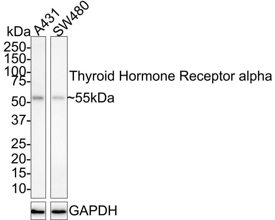 Western blot analysis on different lysates with NBP3-33015 at 1/1,000 dilution. Lane 1: A431 cell lysate Lane 2: SW480 cell lysate Lysates/proteins at 20 µg/Lane. Predicted band size: 55 kDa Observed band size: 55 kDa Exposure time: 3 minutes; 4-20% SDS-PAGE gel. Proteins were transferred to a PVDF membrane and blocked with 5% NFDM/TBST for 1 hour at room temperature. NBP3-33015 at 1/1,000 dilution was used in 5% NFDM/TBST at room temperature for 2 hours. Goat Anti-Rabbit IgG [HRP] Secondary Antibody at 1:100,000 dilution was used for 1 hour at room temperature.