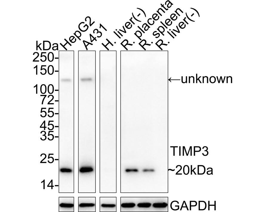 Western blot analysis on different lysates with NBP3-33023 at 1/1,000 dilution. Lane 1: HepG2 cell lysate Lane 2: A431 cell lysate Lane 3: Human liver tissue lysate (negative) Lane 4: Rat placenta tissue lysate Lane 5: Rat spleen tissue lysate Lane 6: Rat liver tissue lysate (negative) Lysates/proteins at 20 µg/Lane. Predicted band size: 24 kDa Observed band size: 20 kDa Exposure time: 46 seconds;  4-20% SDS-PAGE gel. Proteins were transferred to a PVDF membrane and blocked with 5% NFDM/TBST for 1 hour at room temperature. NBP3-33023 at 1/1,000 dilution was used in 5% NFDM/TBST at 4℃ overnight. Goat Anti-Rabbit IgG [HRP] Secondary Antibody at 1/50,000 dilution was used for 1 hour at room temperature.