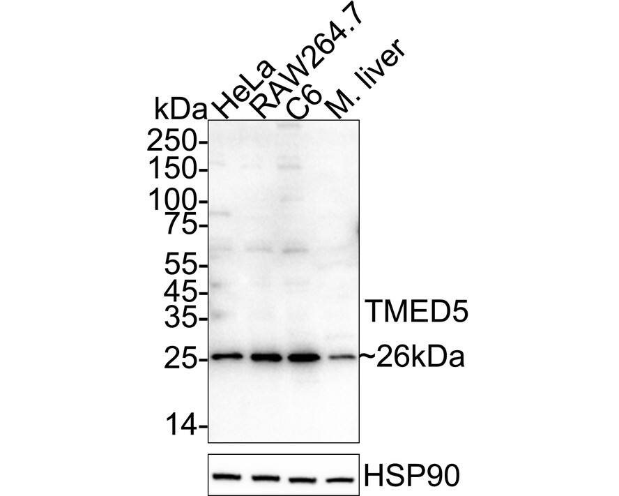 Western Blot TMED5 Antibody