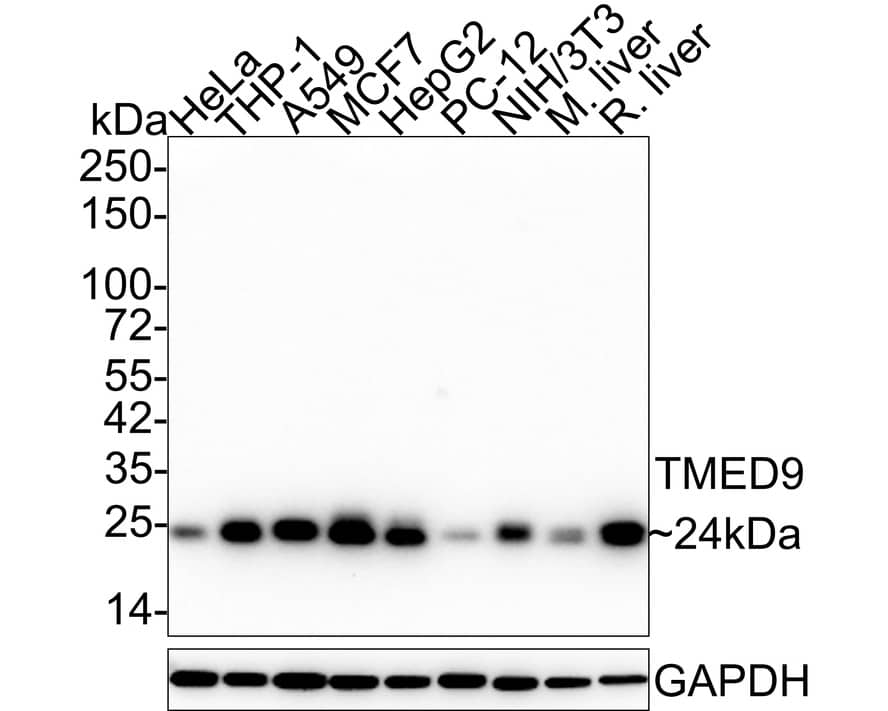 Western Blot TMED9 Antibody (A9A8)