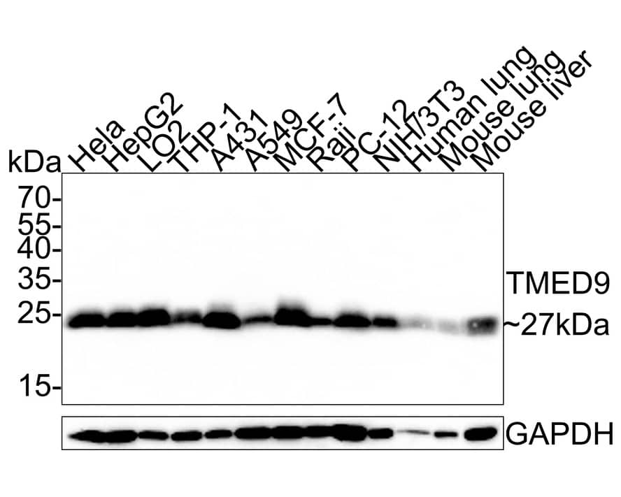 Western Blot: TMED9 Antibody (A9A7-R) [NBP3-33027] - Western blot analysis of TMED9 on different lysates with Mouse anti-TMED9 antibody (NBP3-33027) at 1/1,000 dilution. Lane 1: Hela cell lysate Lane 2: HepG2 cell lysate Lane 3: LO2 cell lysate Lane 4: THP-1 cell lysate Lane 5: A431 cell lysate Lane 6: A549 cell lysate Lane 7: MCF-7 cell lysate Lane 8: Raji cell lysate Lane 9: PC-12 cell lysate Lane 10: NIH/3T3 cell lysate Lane 11: Human lung tissue lysate Lane 12: Mouse lung tissue lysate Lane 13: Mouse liver tissue lysate Lysates/proteins at 30 ug/Lane. Predicted band size: 27 kDa Observed band size: 27 kDa Exposure time: 10 seconds; 12% SDS-PAGE gel. Proteins were transferred to a PVDF membrane and blocked with 5% NFDM/TBST for 1 hour at room temperature. The primary antibody (NBP3-33027) at 1/1,000 dilution was used in 5% NFDM/TBST at room temperature for 2 hours. Goat Anti-Mouse IgG - HRP Secondary Antibody at 1:150,000 dilution was used for 1 hour at room temperature.