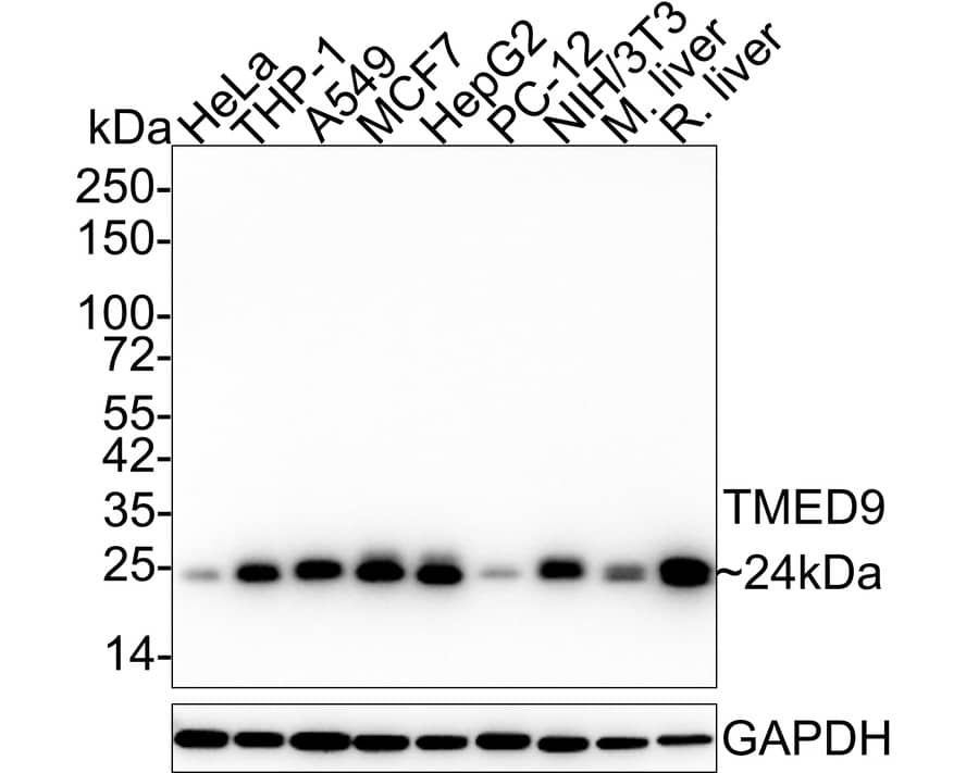 Western Blot: TMED9 Antibody (A9A8-R) [NBP3-33028] - Western blot analysis of TMED9 on different lysates with Mouse anti-TMED9 antibody (NBP3-33028) at 1/1,000 dilution. Lane 1: HeLa cell lysate (20 ug/Lane) Lane 2: THP-1 cell lysate (20 ug/Lane) Lane 3: A549 cell lysate (20 ug/Lane) Lane 4: MCF7 cell lysate (20 ug/Lane) Lane 5: HepG2 cell lysate (20 ug/Lane) Lane 6: PC-12 cell lysate (20 ug/Lane) Lane 7: NIH/3T3 cell lysate (20 ug/Lane) Lane 8: Mouse liver tissue lysate (40 ug/Lane) Lane 9: Rat liver tissue lysate (40 ug/Lane) Predicted band size: 27 kDa Observed band size: 24 kDa Exposure time: 43 seconds; 4-20% SDS-PAGE gel. Proteins were transferred to a PVDF membrane and blocked with 5% NFDM/TBST for 1 hour at room temperature. The primary antibody (NBP3-33028) at 1/1,000 dilution was used in 5% NFDM/TBST at 4C overnight. Anti-Mouse IgG for IP Nano-secondary antibody (NBI02H) at 1/5,000 dilution was used for 1 hour at room temperature.