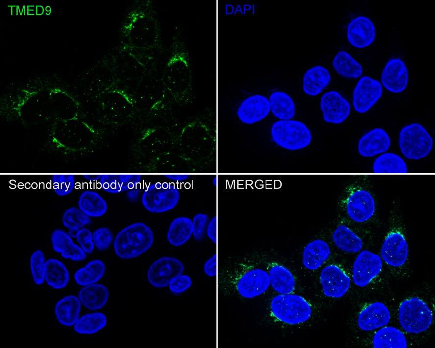 Immunocytochemistry/ Immunofluorescence: TMED9 Antibody (A9A8-R) [NBP3-33028] - Immunocytochemistry analysis of HepG2 cells labeling TMED9 with Mouse anti-TMED9 antibody (NBP3-33028) at 1/100 dilution. Cells were fixed in 100% precooled methanol for 5 minutes at room temperature, then blocked with 1% BSA in 10% negative goat serum for 1 hour at room temperature. Cells were then incubated with Mouse anti-TMED9 antibody (NBP3-33028) at 1/100 dilution in 1% BSA in PBST overnight at 4 ℃. Goat Anti-Mouse IgG H&L (iFluor™ 488) was used as the secondary antibody at 1/1,000 dilution. PBS instead of the primary antibody was used as the secondary antibody only control. Nuclear DNA was labelled in blue with DAPI.