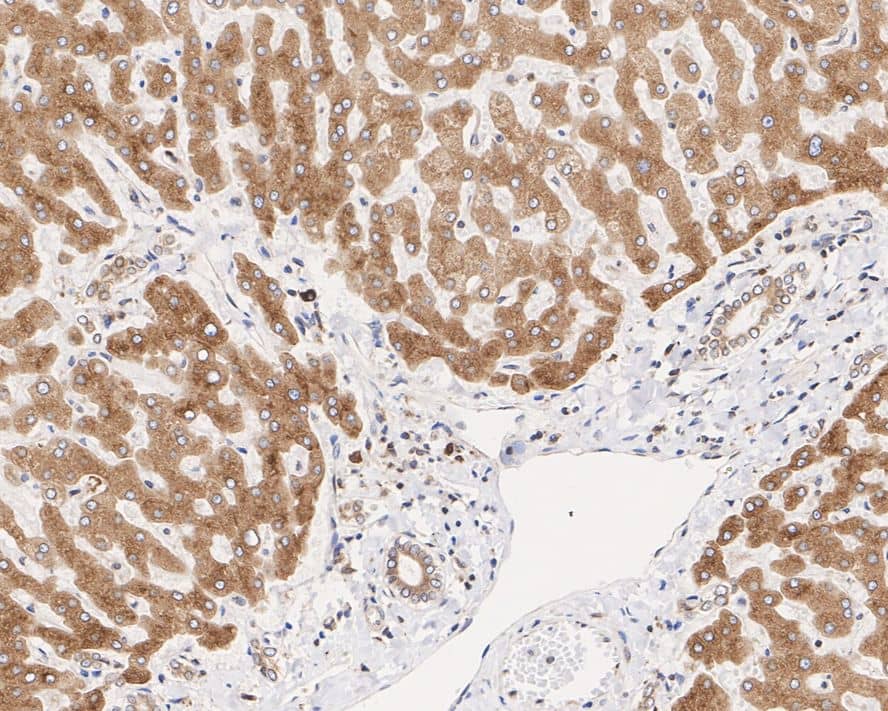 Immunohistochemistry: TMED9 Antibody (A9A8-R) [NBP3-33028] - Immunohistochemical analysis of paraffin-embedded human liver tissue with Mouse anti-TMED9 antibody (NBP3-33028) at 1/2,000 dilution. The section was pre-treated using heat mediated antigen retrieval with Tris-EDTA buffer (pH 9.0) for 20 minutes. The tissues were blocked in 1% BSA for 20 minutes at room temperature, washed with ddH2O and PBS, and then probed with the primary antibody (NBP3-33028) at 1/2,000 dilution for 1 hour at room temperature. The detection was performed using an HRP conjugated compact polymer system. DAB was used as the chromogen. Tissues were counterstained with hematoxylin and mounted with DPX.