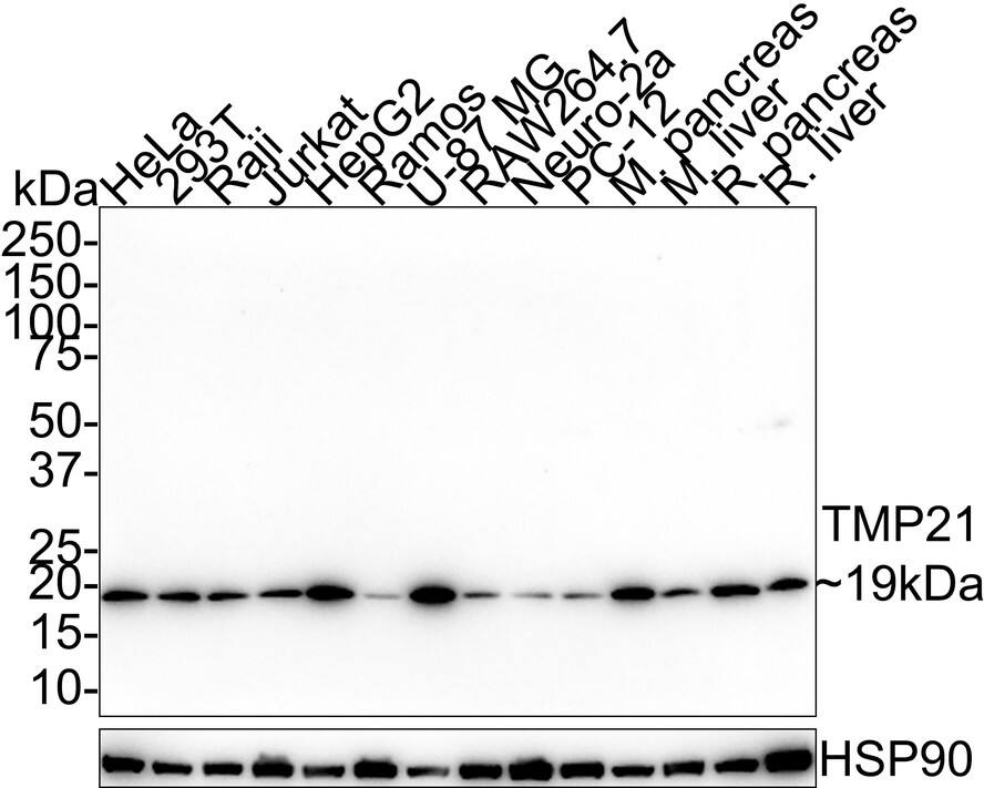 Western blot analysis on different lysates with NBP3-33030 at 1/5,000 dilution. Lane 1: HeLa cell lysate (20 µg/Lane) Lane 2: 293T cell lysate (20 µg/Lane) Lane 3: Raji cell lysate (20 µg/Lane) Lane 4: Jurkat cell lysate (20 µg/Lane) Lane 5: HepG2 cell lysate (20 µg/Lane) Lane 6: Ramos cell lysate (20 µg/Lane) Lane 7: U-87 MG cell lysate (20 µg/Lane) Lane 8: RAW264.7 cell lysate (20 µg/Lane) Lane 9: Neuro-2a cell lysate (20 µg/Lane) Lane 10: PC-12 cell lysate (20 µg/Lane) Lane 11: Mouse pancreas tissue lysate (40 µg/Lane) Lane 12: Mouse liver tissue lysate (40 µg/Lane) Lane 13: Rat pancreas tissue lysate (40 µg/Lane) Lane 14: Rat liver tissue lysate (40 µg/Lane) Predicted band size: 25 kDa Observed band size: 19 kDa Exposure time: 2 minutes 13 seconds; 4-20% SDS-PAGE gel. Proteins were transferred to a PVDF membrane and blocked with 5% NFDM/TBST for 1 hour at room temperature. NBP3-33030 at 1/5,000 dilution was used in 5% NFDM/TBST at room temperature for 2 hours. Goat Anti-Rabbit IgG [HRP] Secondary Antibody at 1/50,000 dilution was used for 1 hour at room temperature.