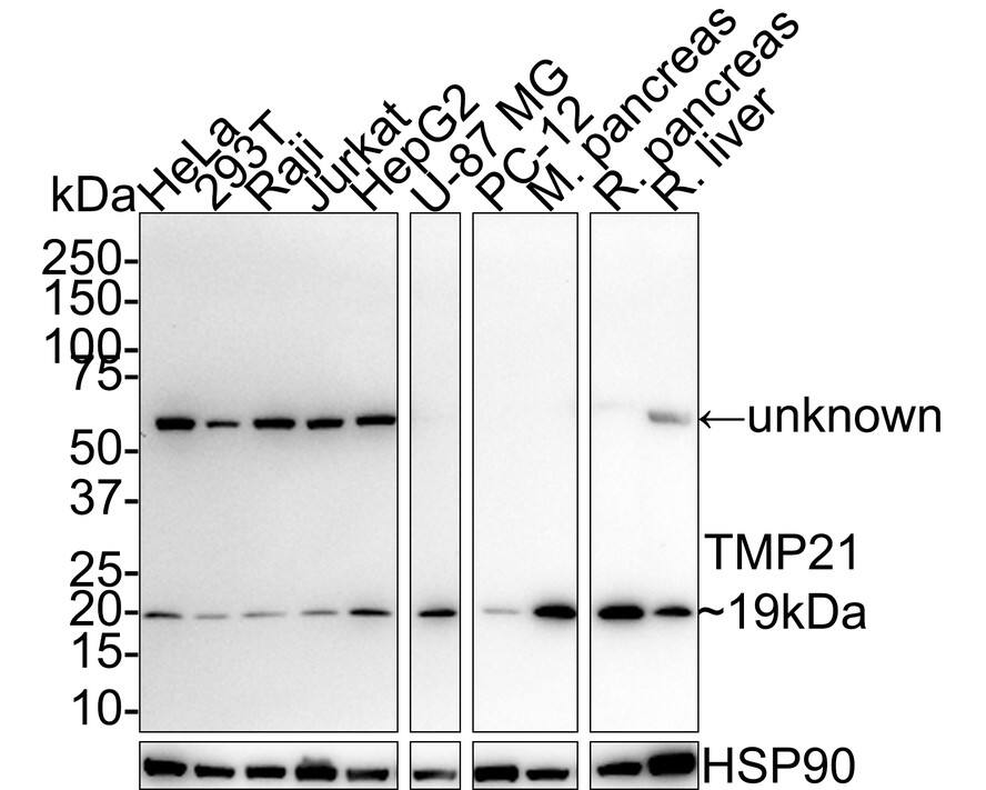 Western blot analysis on different lysates with NBP3-33031 at 1/5,000 dilution. Lane 1: HeLa cell lysate (20 µg/Lane) Lane 2: 293T cell lysate (20 µg/Lane) Lane 3: Raji cell lysate (20 µg/Lane) Lane 4: Jurkat cell lysate (20 µg/Lane) Lane 5: HepG2 cell lysate (20 µg/Lane) Lane 6: U-87 MG cell lysate (20 µg/Lane) Lane 7: PC-12 cell lysate (20 µg/Lane) Lane 8: Mouse pancreas tissue lysate (40 µg/Lane) Lane 9: Rat pancreas tissue lysate (40 µg/Lane) Lane 10: Rat liver tissue lysate (40 µg/Lane) Predicted band size: 25 kDa Observed band size: 19 kDa Exposure time: 5 minutes 10 seconds; 4-20% SDS-PAGE gel. Proteins were transferred to a PVDF membrane and blocked with 5% NFDM/TBST for 1 hour at room temperature. NBP3-33031 at 1/5,000 dilution was used in 5% NFDM/TBST at room temperature for 2 hours. Goat Anti-Rabbit IgG [HRP] Secondary Antibody at 1/50,000 dilution was used for 1 hour at room temperature.