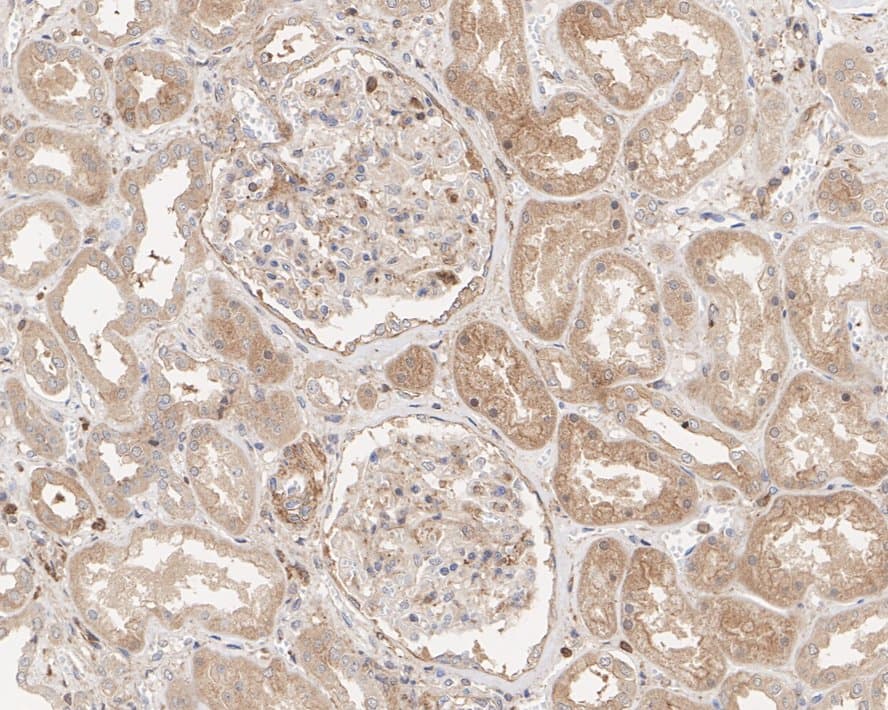 Immunohistochemistry: TOM1 Antibody (PSH03-38) [NBP3-33035] - Immunohistochemical analysis of paraffin-embedded human kidney tissue with Rabbit anti-TOM1 antibody (NBP3-33035) at 1/200 dilution. The section was pre-treated using heat mediated antigen retrieval with Tris-EDTA buffer (pH 9.0) for 20 minutes. The tissues were blocked in 1% BSA for 20 minutes at room temperature, washed with ddH2O and PBS, and then probed with the primary antibody (NBP3-33035) at 1/200 dilution for 1 hour at room temperature. The detection was performed using an HRP conjugated compact polymer system. DAB was used as the chromogen. Tissues were counterstained with hematoxylin and mounted with DPX.