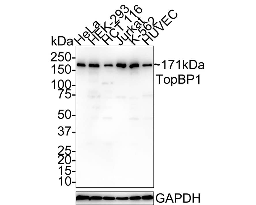 Western Blot: TopBP1 Antibody (PSH01-14) [NBP3-33036] - Western blot analysis of TopBP1 on different lysates with Rabbit anti-TopBP1 antibody (NBP3-33036) at 1/1,000 dilution. Lane 1: HeLa cell lysate Lane 2: HEK-293 cell lysate Lane 3: HCT 116 cell lysate Lane 4: Jurkat cell lysate Lane 5: K-562 cell lysate Lane 6: HUVEC cell lysate Lysates/proteins at 20 ug/Lane. Predicted band size: 171 kDa Observed band size: 171 kDa Exposure time: 3 minutes 10 seconds; 4-20% SDS-PAGE gel. Proteins were transferred to a PVDF membrane and blocked with 5% NFDM/TBST for 1 hour at room temperature. The primary antibody (NBP3-33036) at 1/1,000 dilution was used in 5% NFDM/TBST at room temperature for 2 hours. Goat Anti-Rabbit IgG - HRP Secondary Antibody at 1:100,000 dilution was used for 1 hour at room temperature.